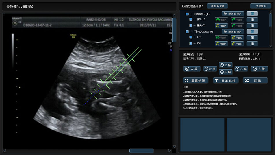 武漢睿影醫(yī)療科技超聲系統(tǒng)軟件界面設計